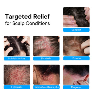 ProBliva Psoriasis Scalp Spray