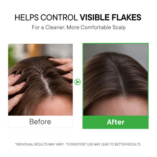 ProBliva Dandruff Shampoo