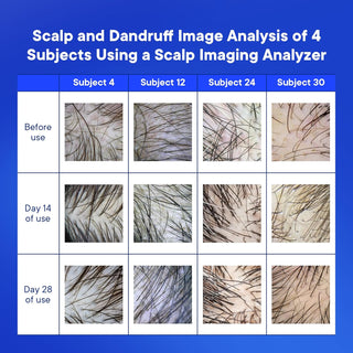 Medicated Anti-Fungal Shampoo - Extra Strength for Dandruff, Folliculitis, Psoriasis & Itchy Scalp