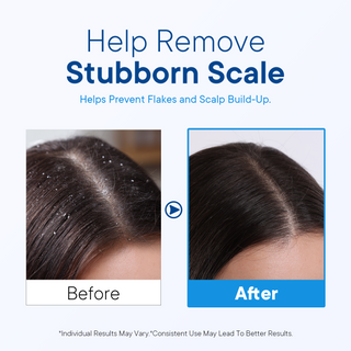 ProBliva Psoriasis Shampoo