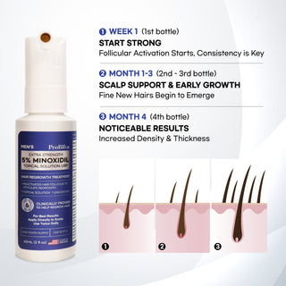 5% Minoxidil Hair Growth Treatment for Men - 2 fl oz - Made in USA