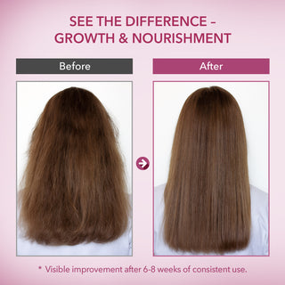 Onion & Rosemary Hair Growth Conditioner: Biotin Infused Nourishing Formula for Thinning, Dry, Breakage & Damaged Hair – Moisturizing & Strengthening Conditioner for Women and Men - 16.9 Fl Oz