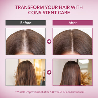 Onion Biotin & Rosemary Shampoo